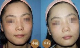 徒手祛斑爆料视频大全集,视频大全集深度解析